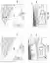 Fig. 40 - Attachable cart system and method