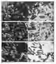 Fig. 01 - STABLE SOLID FORMS OF ENCLOMIPHENE AND ENCLOMIPHENE CITRATE