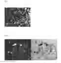 Fig. 08 - STABLE SOLID FORMS OF ENCLOMIPHENE AND ENCLOMIPHENE CITRATE