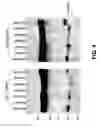 Fig. 07 - COMPOSITIONS AND METHODS OF TREATING DISEASE WITH FGFR FUSION PROTEINS