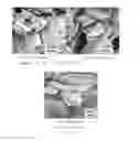 Fig. 16 - Method for producing anisotropic zinc phosphate particles