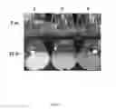 Fig. 09 - Expression constructs and methods of genetically engineering methylotrophic yeast