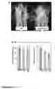 Fig. 05 - Modulation of expression of acyltransferases to modify hydroxycinnamic acid content