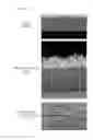 Fig. 08 - PLATED STEEL SHEET HAVING EXCELLENT ADHESION PROPERTY AND MANUFACTURING METHOD THEREFOR