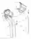 Fig. 14 - Shovel handle with bail over dipper feature