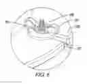 Fig. 07 - Pool skimmer basket system