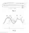 Fig. 02 - Planet for a planetary rolling-contact screw