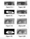 Fig. 07 - Eye beautification under inaccurate localization
