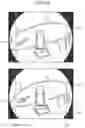 Fig. 12 - Image processing device for vehicle