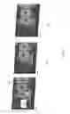 Fig. 07 - Apparatus and method for transmission of millimeter wave signals