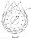 Fig. 03 - Coil winding arrangement