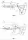 Fig. 02 - Spectrally encoded endoscopic probe having a fixed fiber