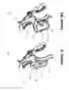 Fig. 16 - ERGONOMIC MULTI-FUNCTIONAL HANDLE FOR USE WITH A MEDICAL INSTRUMENT
