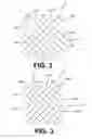 Fig. 03 - BRAIDED MEDICAL DEVICES
