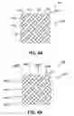 Fig. 04 - BRAIDED MEDICAL DEVICES