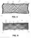 Fig. 07 - BRAIDED MEDICAL DEVICES