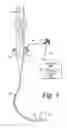 Fig. 02 - Suction cannula for removal of duct blockage