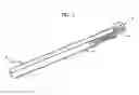 Fig. 02 - Spinal surgery distraction with an integrated retractor