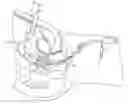 Fig. 01 - Uterine manipulator