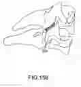 Fig. 131 - Vertebral joint implants and delivery tools
