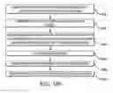 Fig. 151 - Vertebral joint implants and delivery tools
