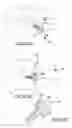 Fig. 32 - Vertebral joint implants and delivery tools