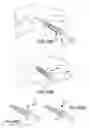 Fig. 37 - Vertebral joint implants and delivery tools