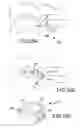 Fig. 46 - Vertebral joint implants and delivery tools