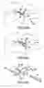 Fig. 47 - Vertebral joint implants and delivery tools