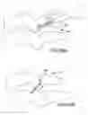 Fig. 49 - Vertebral joint implants and delivery tools