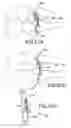 Fig. 52 - Vertebral joint implants and delivery tools