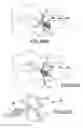 Fig. 55 - Vertebral joint implants and delivery tools