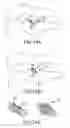 Fig. 65 - Vertebral joint implants and delivery tools