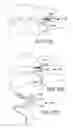 Fig. 68 - Vertebral joint implants and delivery tools