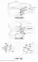 Fig. 70 - Vertebral joint implants and delivery tools