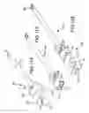 Fig. 92 - Vertebral joint implants and delivery tools