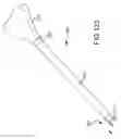 Fig. 97 - Vertebral joint implants and delivery tools