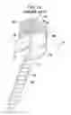 Fig. 02 - Bone anchor assemblies with multiple component bottom loading bone anchors