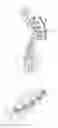 Fig. 01 - Methods for correction of spinal deformities