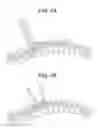 Fig. 07 - Methods for correction of spinal deformities
