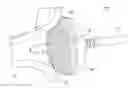 Fig. 01 - Balloon-type ablation catheter and ablation catheter device