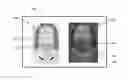 Fig. 01 - Systems and methods for planning hair transplantation