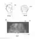Fig. 03 - Systems and methods for planning hair transplantation