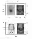 Fig. 04 - Systems and methods for planning hair transplantation