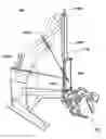 Fig. 01 - Methods, systems, and devices relating to robotic surgical devices, end effectors, and controllers