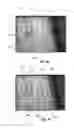 Fig. 06 - Methods and systems for directing movement of a tool in hair transplantation procedures