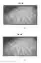 Fig. 10 - Methods and systems for directing movement of a tool in hair transplantation procedures
