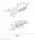 Fig. 10 - Surgical cleaning tool, system, and method