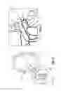 Fig. 04 - Dental covering removal tool