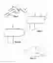 Fig. 05 - Dental covering removal tool